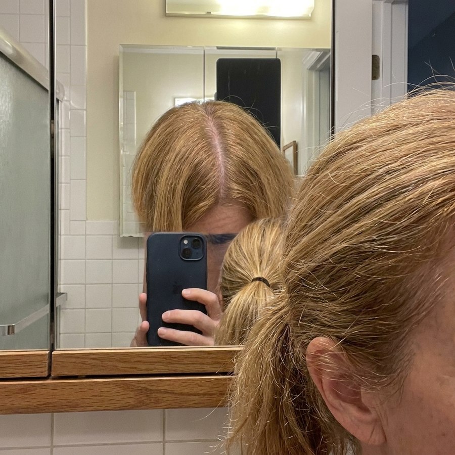Documenting hair thinning from behind